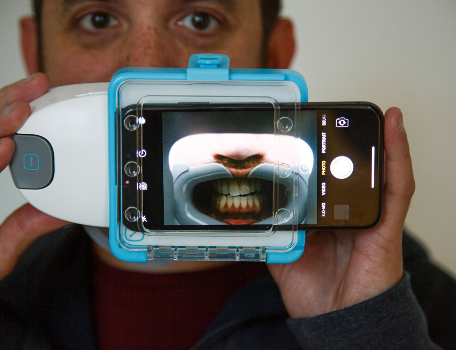 How does Dental Monitoring work?