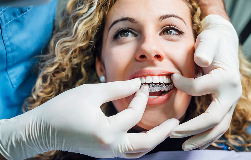 How Often Should You Change Angel Aligners? Your Week-by-Week Guide